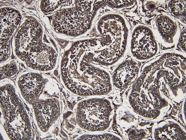 DJ-1 Antibody in Immunohistochemistry (Paraffin) (IHC (P))