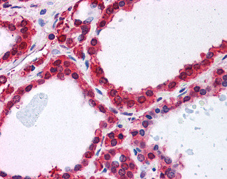 DJ-1 Antibody in Immunohistochemistry (Paraffin) (IHC (P))