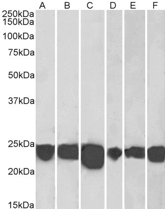 DJ-1 Antibody in Western Blot (WB)