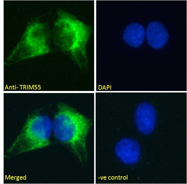 MURF2 Antibody in Immunocytochemistry (ICC/IF)