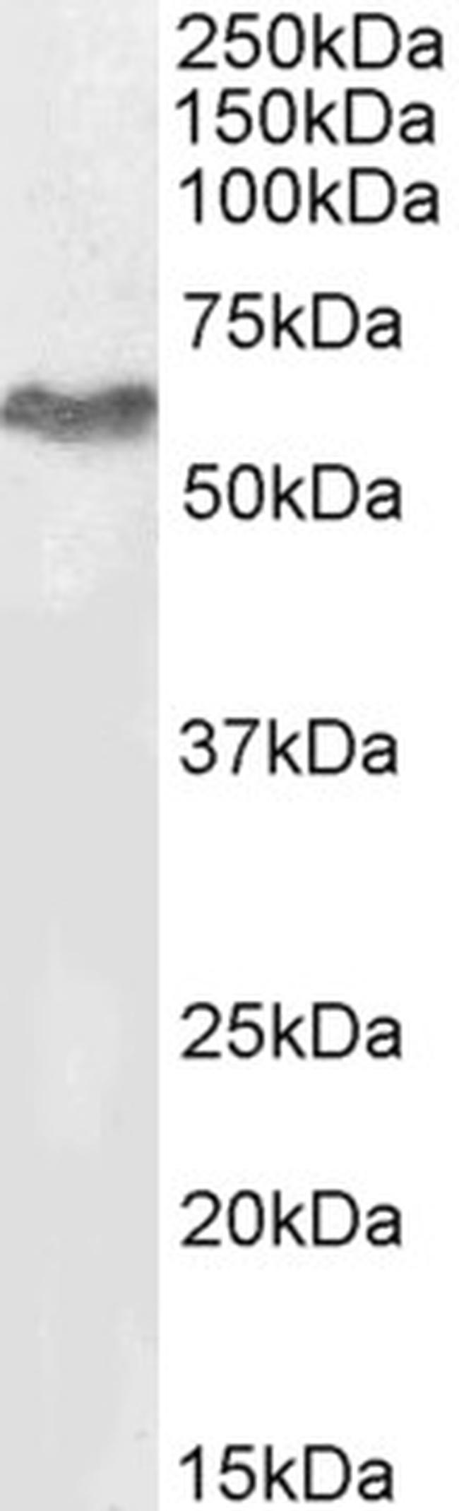 MURF2 Antibody in Western Blot (WB)