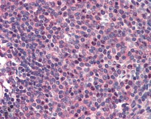 CARD11 Antibody in Immunohistochemistry (Paraffin) (IHC (P))