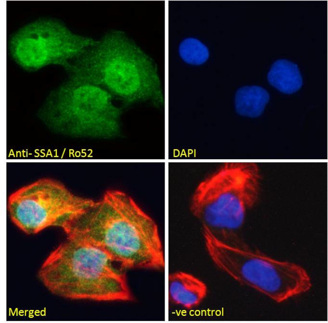 TRIM21 Antibody in Immunocytochemistry (ICC/IF)