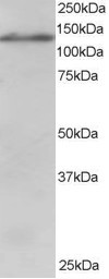 USP11 Antibody in Western Blot (WB)