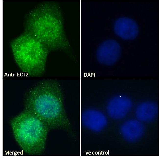 ECT2 Antibody in Immunocytochemistry (ICC/IF)