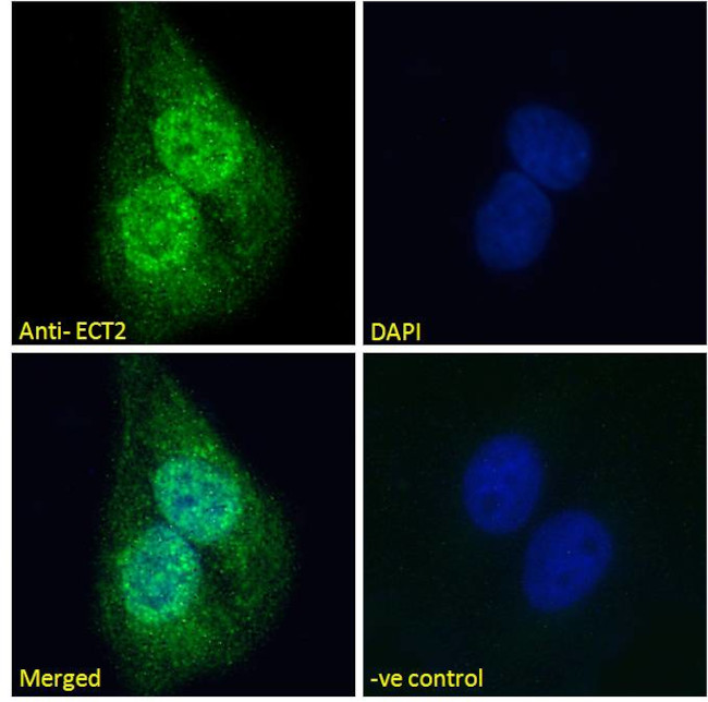 ECT2 Antibody in Immunocytochemistry (ICC/IF)