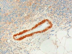 USP20 Antibody in Immunohistochemistry (Paraffin) (IHC (P))