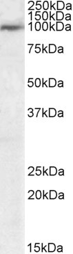 USP20 Antibody in Western Blot (WB)