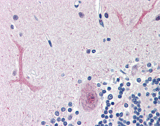 FOXC1 Antibody in Immunohistochemistry (Paraffin) (IHC (P))