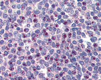 FOXC1 Antibody in Immunohistochemistry (Paraffin) (IHC (P))