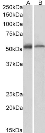 ETEA Antibody in Western Blot (WB)