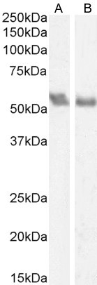 Coronin 1A Antibody in Western Blot (WB)