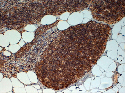 FOXN1 Antibody in Immunohistochemistry (Paraffin) (IHC (P))