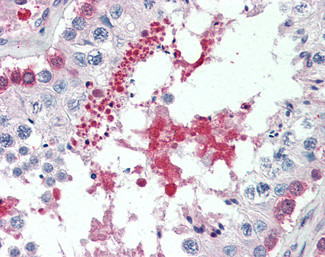 SIL1 Antibody in Immunohistochemistry (Paraffin) (IHC (P))