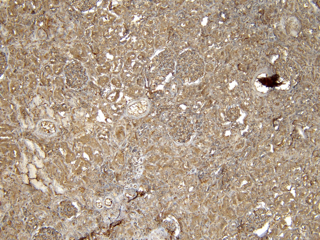 EPS8 Antibody in Immunohistochemistry (Paraffin) (IHC (P))