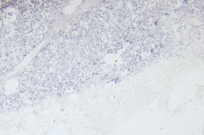 EPS8 Antibody in Immunohistochemistry (Paraffin) (IHC (P))