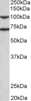 EPS8 Antibody in Western Blot (WB)