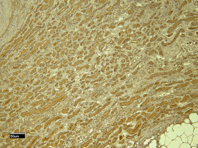 PTBP1 Antibody in Immunohistochemistry (Paraffin) (IHC (P))