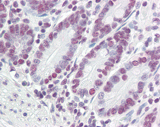 PTBP1 Antibody in Immunohistochemistry (Paraffin) (IHC (P))