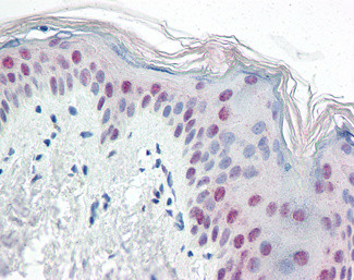 PTBP1 Antibody in Immunohistochemistry (Paraffin) (IHC (P))