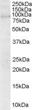 ARHGEF4 Antibody in Western Blot (WB)