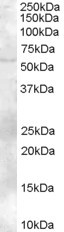 TZFP Antibody in Western Blot (WB)