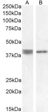 ATP6IP2 Antibody in Western Blot (WB)