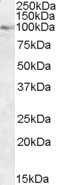 OSBP Antibody in Western Blot (WB)