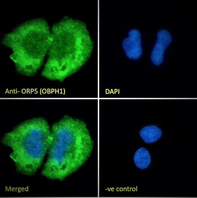 ORP5 Antibody in Immunocytochemistry (ICC/IF)