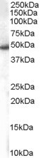 SNX5 Antibody in Western Blot (WB)