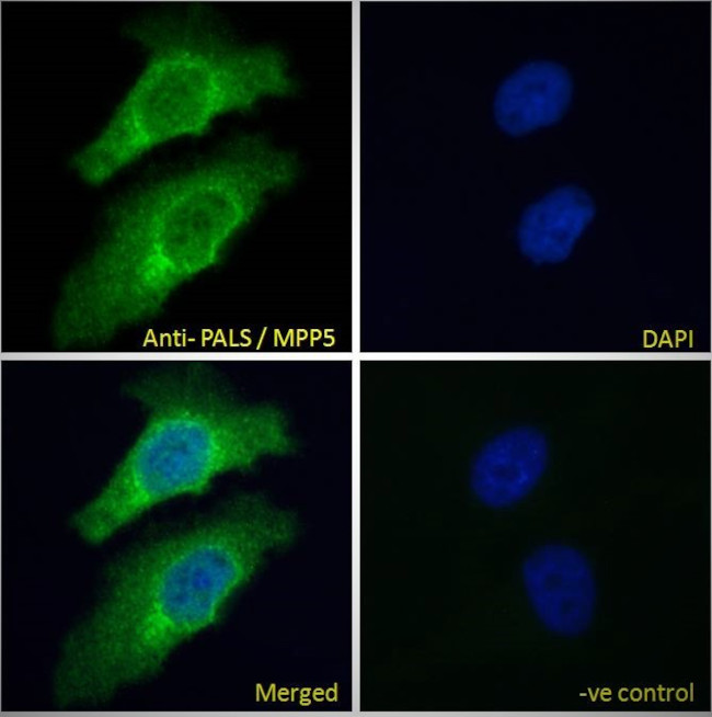 MPP5 Antibody in Immunocytochemistry (ICC/IF)