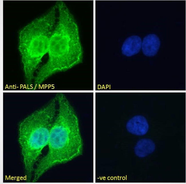 MPP5 Antibody in Immunocytochemistry (ICC/IF)