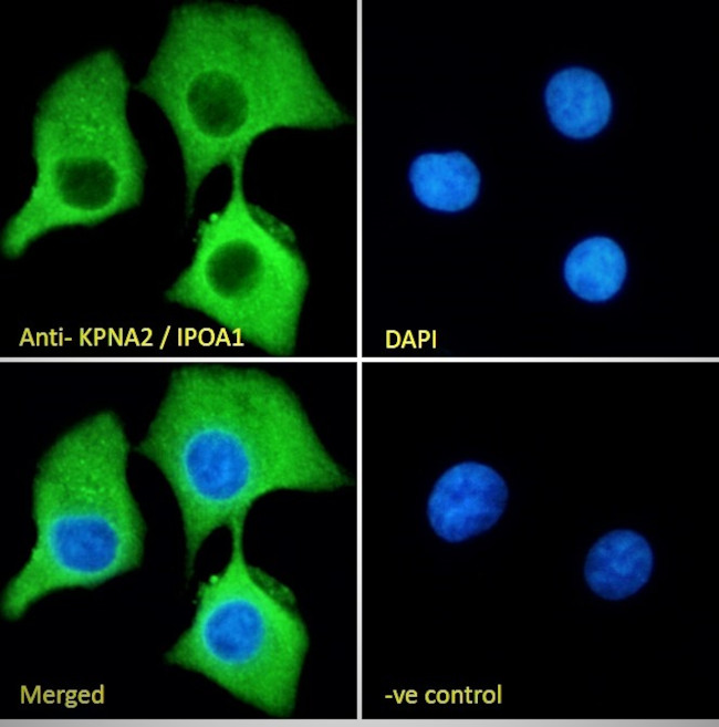 KPNA2 Antibody in Immunocytochemistry (ICC/IF)