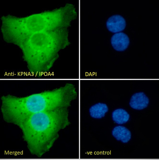 KPNA3 Antibody in Immunocytochemistry (ICC/IF)