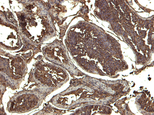 KPNA3 Antibody in Immunohistochemistry (Paraffin) (IHC (P))