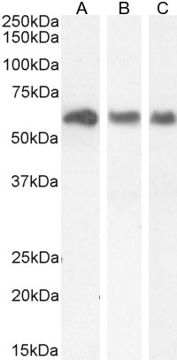 KPNA3 Antibody in Western Blot (WB)