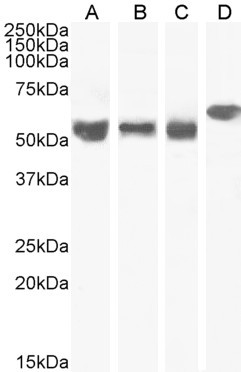 KPNA4 Antibody in Western Blot (WB)