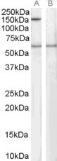 SIPA1 Antibody in Western Blot (WB)