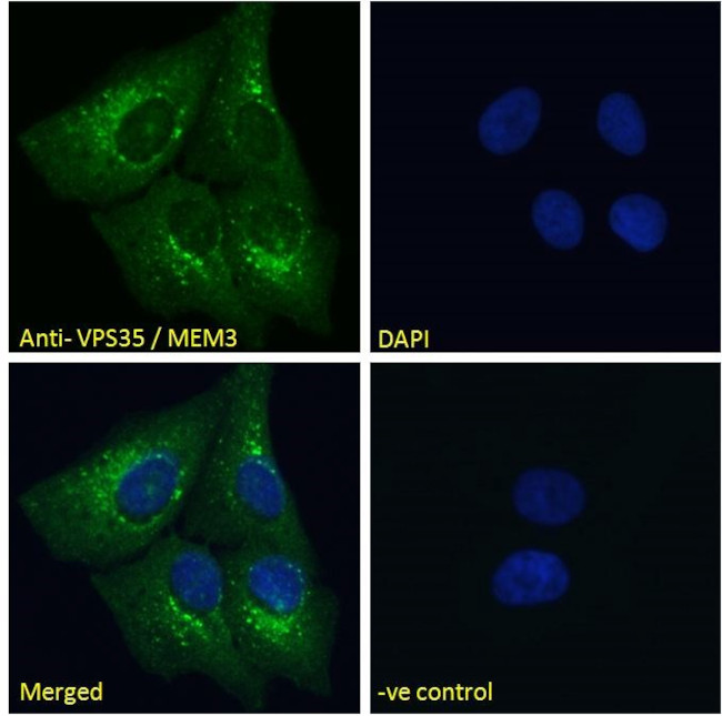 VPS35 Antibody in Immunocytochemistry (ICC/IF)