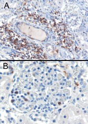 SH3BP1 Antibody in Immunohistochemistry (Paraffin) (IHC (P))