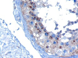 VPS28 Antibody in Immunohistochemistry (Paraffin) (IHC (P))