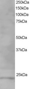 VPS28 Antibody in Western Blot (WB)