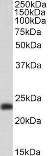 TAGLN Antibody in Western Blot (WB)