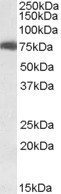 USH1C Antibody in Western Blot (WB)