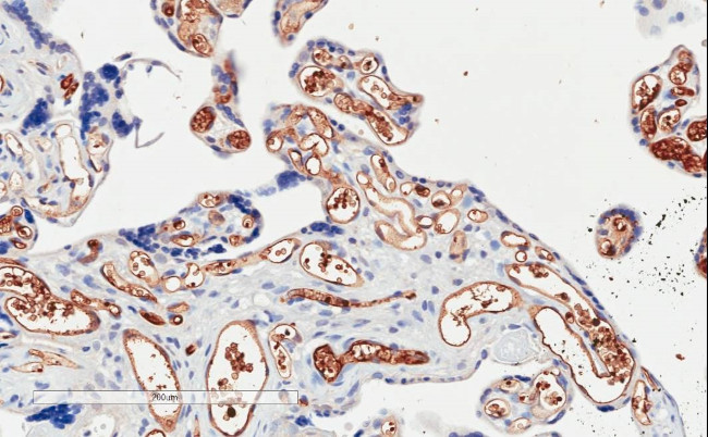 PIK3C2A Antibody in Immunohistochemistry (Paraffin) (IHC (P))