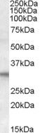 FHL2 Antibody in Western Blot (WB)