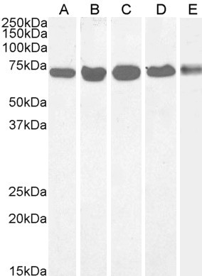 DDX5 Antibody in Western Blot (WB)