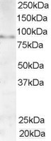 AKAP3 Antibody in Western Blot (WB)