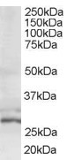 TIP30 Antibody in Western Blot (WB)