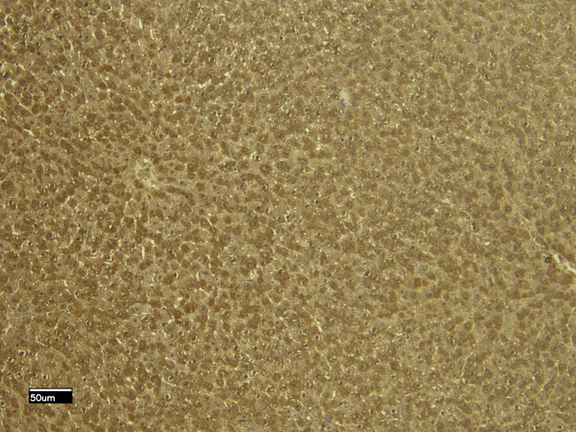 VDAC2 Antibody in Immunohistochemistry (Paraffin) (IHC (P))